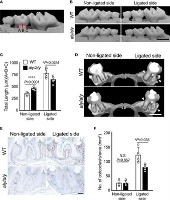 Inhibition of non-canonical NF-κB signaling suppresses periodontal inflammation and bone loss